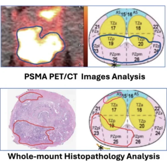 Head-to-head Comparison of Multimodal Imaging