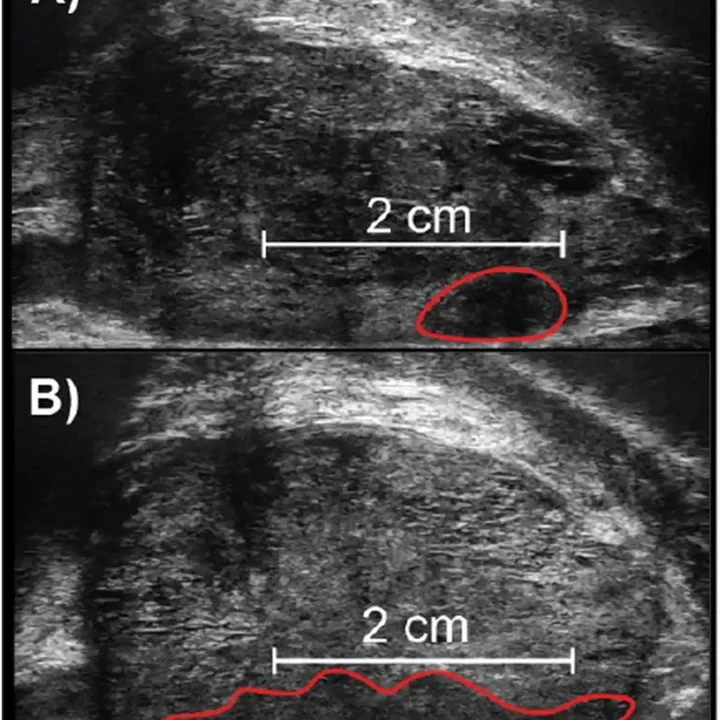 Using Sagittal Length to Differentiate